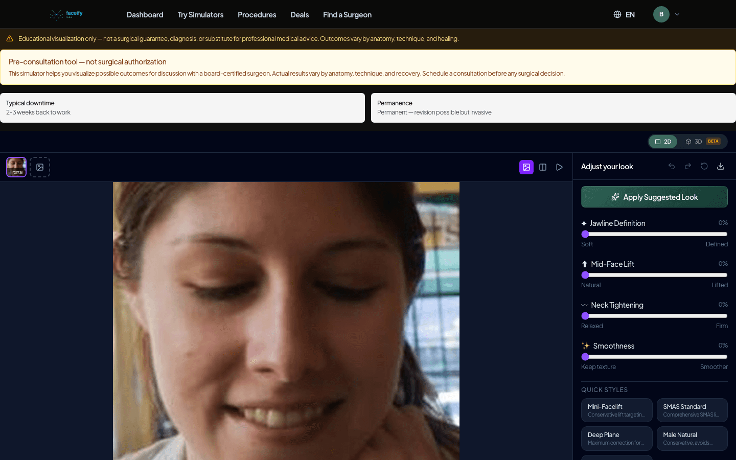 Facelift — AI Simulation Preview · Fixture 3 — Before