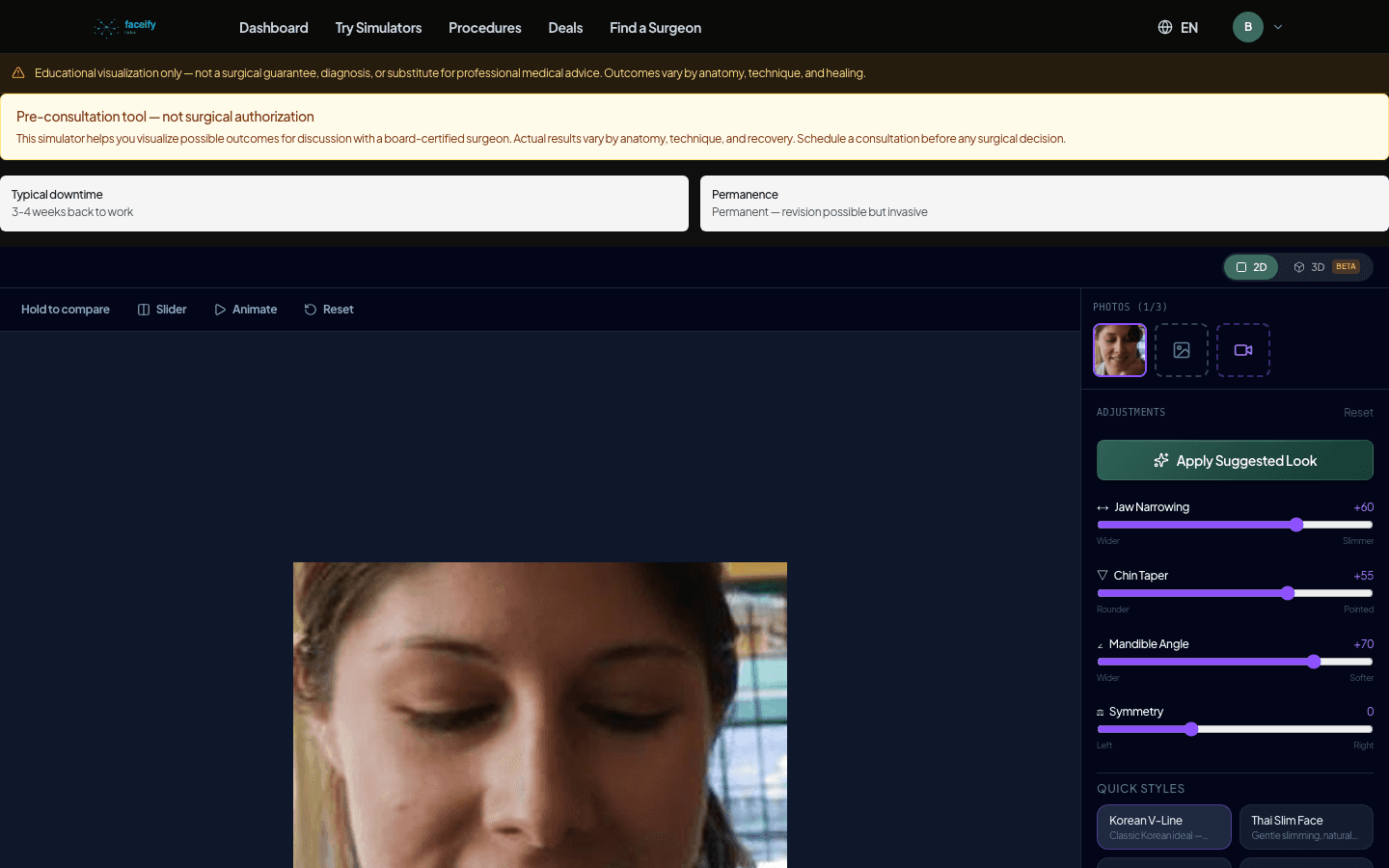 Facial Contouring — AI Simulation Preview · Fixture 3 — After