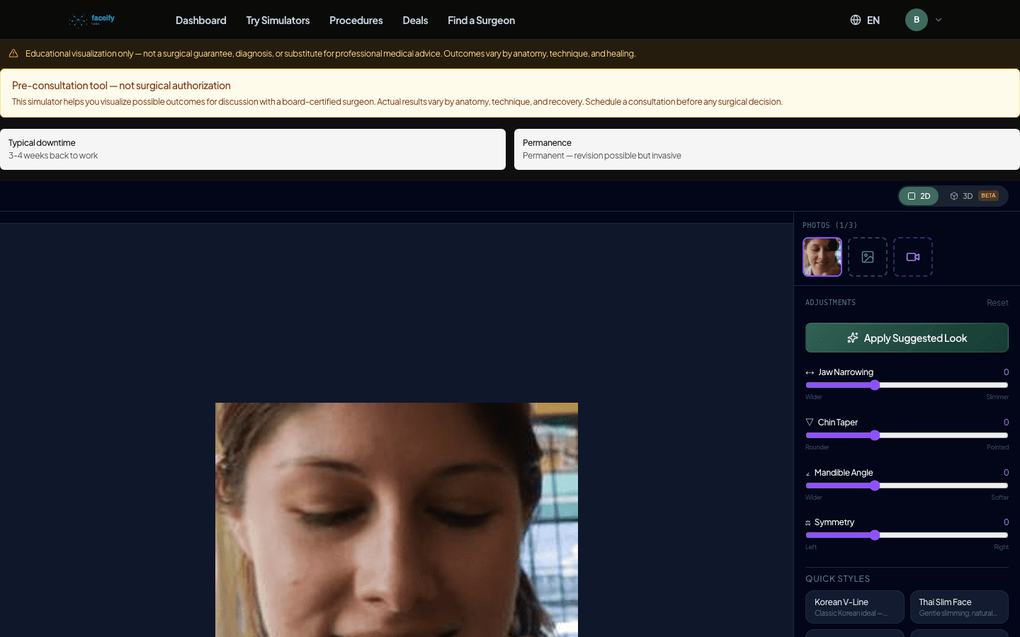 Facial Contouring — AI Simulation Preview · Fixture 3 — Before